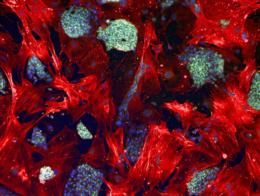 Embryonic Stem Cell Research in the USA Essay Embryonic Stem Cell Research in the USA Essay